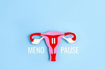 FAQs About Menopause