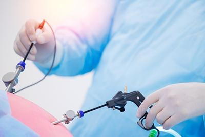 The Role of Minimally Invasive Techniques in Modern Hysterectomy Surgery